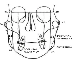 Manual Illustration